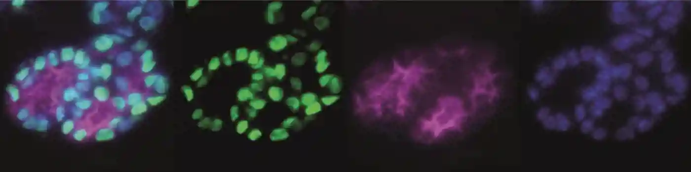 In vitro development of ESC-derived thyroid follicular cells by directed differentiation: immunofluorescence microscopy of day 30 follicular-like structures after immunostaining for Nkx2-1 and thyroglobulin (Tg). Nuclei are counterstained with DAPI; scale bars 10&#181;m. Reproduced with permission from Figure 5F, Kurman et al. 2015 Cell Stem Cell 17 527–542.