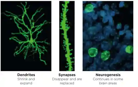 Figure 3. Hormones are involved in regulating brain architecture that includes remodelling of dendrites, turnover of synapses and neurogenesis in the adult as well as in the developing brain. &#169;E Gould, Princeton University