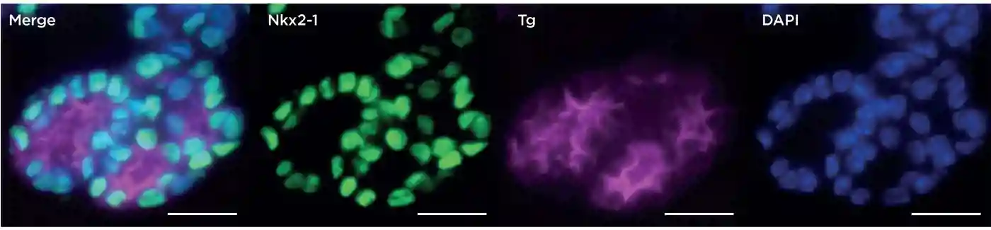 In vitro development of ESC-derived thyroid follicular cells by directed differentiation: immunofluorescence microscopy of day 30 follicular-like structures after immunostaining for Nkx2-1 and thyroglobulin (Tg). Nuclei are counterstained with DAPI; scale bars 10&#181;m. Reproduced with permission from Figure 5F, Kurman et al. 2015 Cell Stem Cell 17 527 542