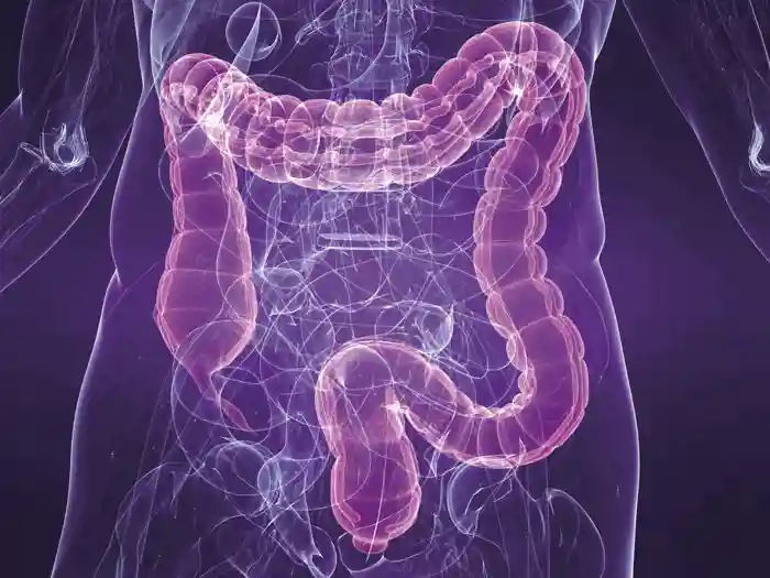 P4 Colon image.jpg