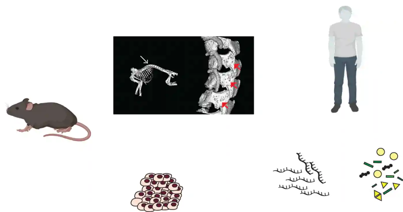 Figure. A mouse model for MSS has helped identify new features in patients which should be monitored as part of their care, as well as new genes and pathways which are altered, that could potentially be therapeutic targets for MSS and MAL. qRT−PCR, quantitative reverse transcription−polymerase chain reaction.